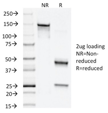 Data from SDS-PAGE analysis of Anti-Napsin A antibody (Clone NAPSA/1238). Reducing lane (R) shows heavy and light chain fragments. NR lane shows intact antibody with expected MW of approximately 150 kDa. The data are consistent with a high purity, intact mAb.